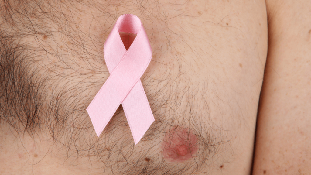 Breast cancer in men?